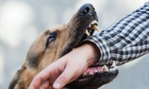 Why Choose Bello Law Firm, PLLC, to Help Me After a Dog Bite Incident in Raleigh, North Carolina?